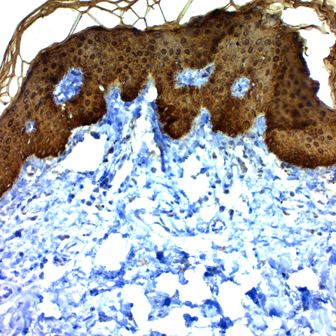 Cytokeratin, Multi (Basic); Clone AE-3 (Ready-To-Use)